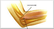 All tennis Elbow Supports